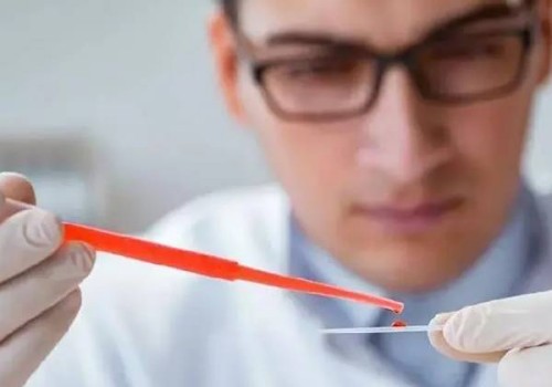 杭州供精代生：﻿中医治疗巧囊有妙招，这两个治疗巧囊的方法记得收藏
