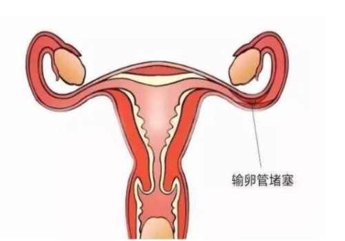 2022例假一直不来，这是推迟了还是怀孕了?
