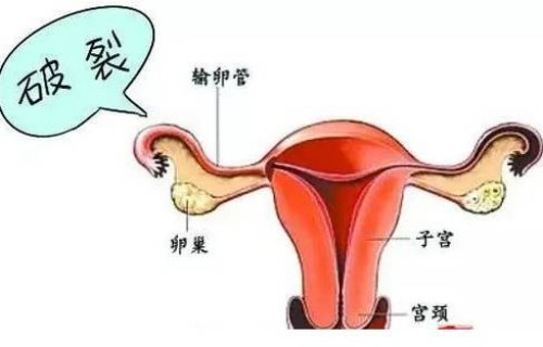 杭州代怀生男孩：﻿孕41周不打催产针的危害一览，会危及胎儿生命并非谣言