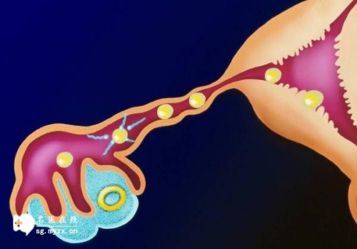 杭州代怀生男孩价格：﻿孕妇患有妊娠糖尿病可以通过什么食物来调理改善病情